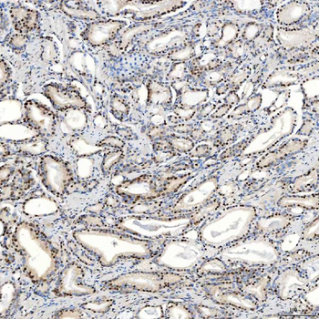 U1-C/SNRPC Antibody