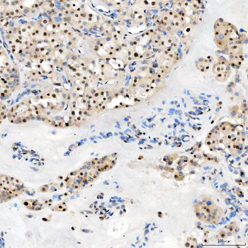 U1-C/SNRPC Antibody
