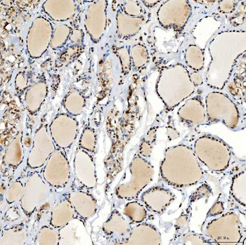 U1-C/SNRPC Antibody
