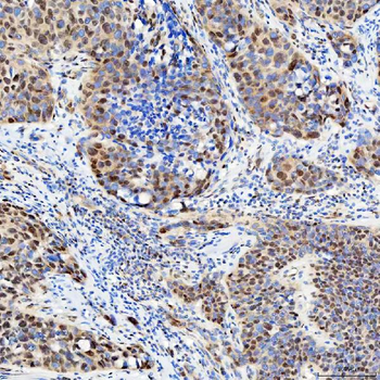 U1-C/SNRPC Antibody