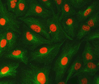 U1-C/SNRPC Antibody