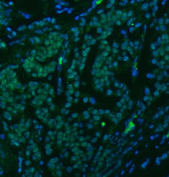 U1-C/SNRPC Antibody