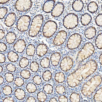 U1-C/SNRPC Antibody