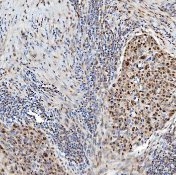 U1-C/SNRPC Antibody