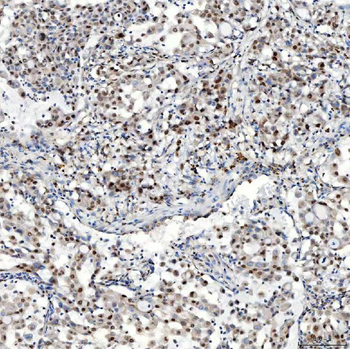 U1-C/SNRPC Antibody
