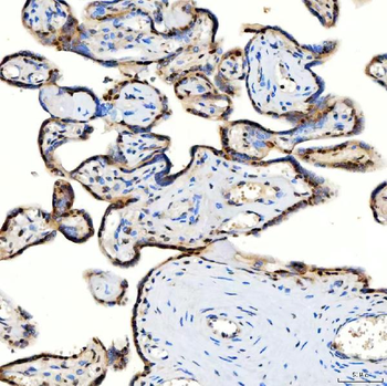 U1-C/SNRPC Antibody