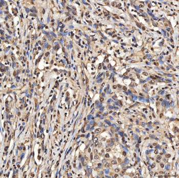 SNRPA1 Antibody