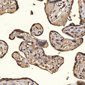 SNRPA1 Antibody