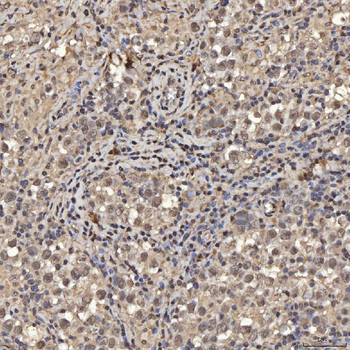 SNRPA1 Antibody