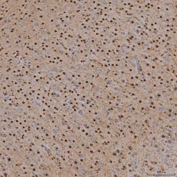 SNRPA1 Antibody
