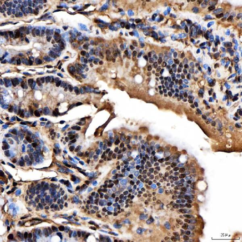 SNRPA1 Antibody