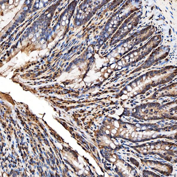 SNRPA1 Antibody