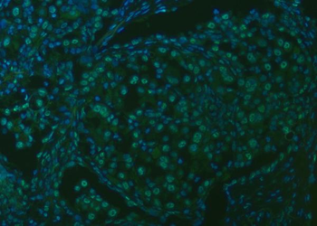 SNRPA1 Antibody