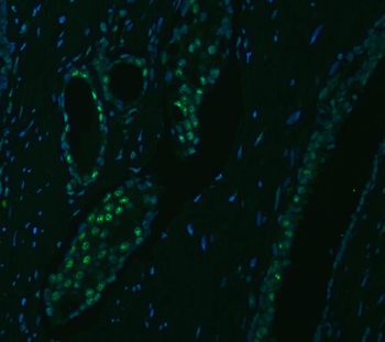 SNRPA1 Antibody
