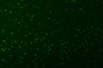 SNRPA1 Antibody