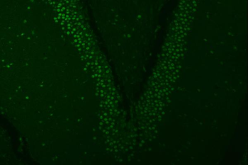 SNRPA1 Antibody