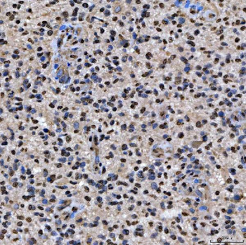 SNRPA1 Antibody