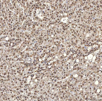 U1A/SNRPA Antibody