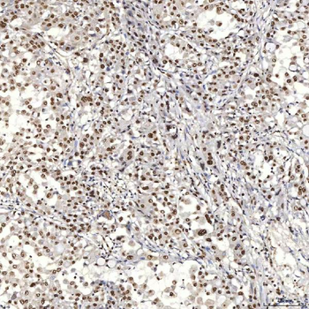 U1A/SNRPA Antibody