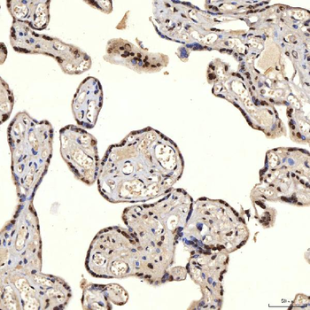 U1A/SNRPA Antibody