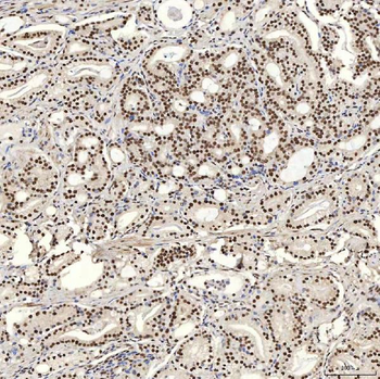 U1A/SNRPA Antibody