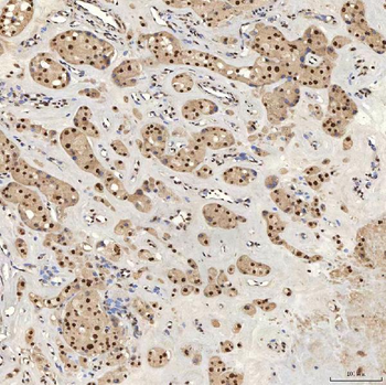 U1A/SNRPA Antibody