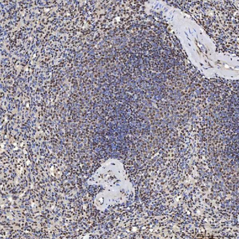 U1A/SNRPA Antibody