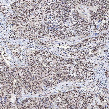 U1A/SNRPA Antibody