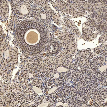 U1A/SNRPA Antibody