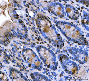 U1A/SNRPA Antibody