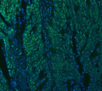 U1A/SNRPA Antibody