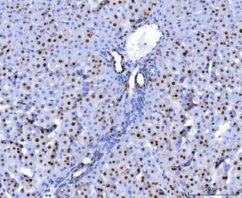 U1A/SNRPA Antibody