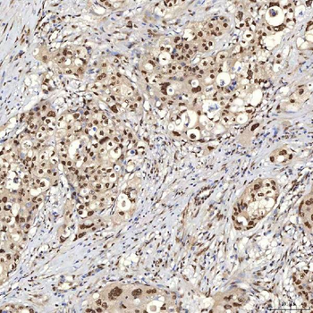 U1A/SNRPA Antibody