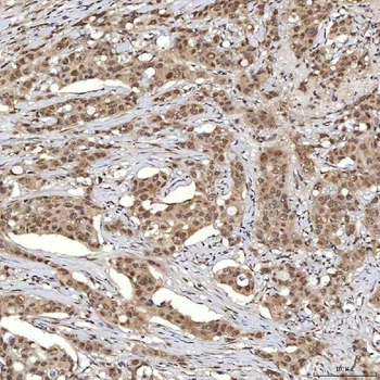 U1A/SNRPA Antibody