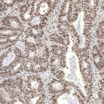 U1A/SNRPA Antibody