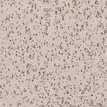 U1A/SNRPA Antibody