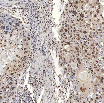 U1A/SNRPA Antibody