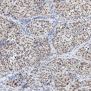 SNRNP200 Antibody
