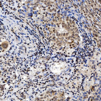 SNRNP200 Antibody