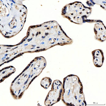 SNRNP200 Antibody