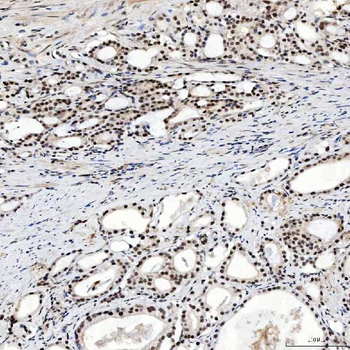 SNRNP200 Antibody