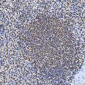SNRNP200 Antibody