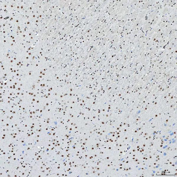 SNRNP200 Antibody