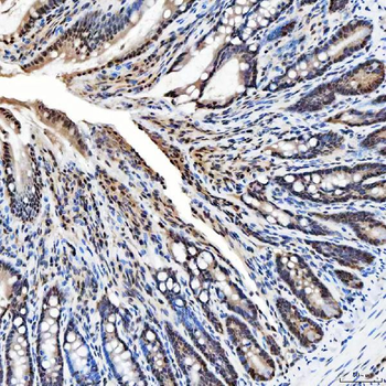 SNRNP200 Antibody
