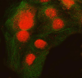 SNRNP200 Antibody