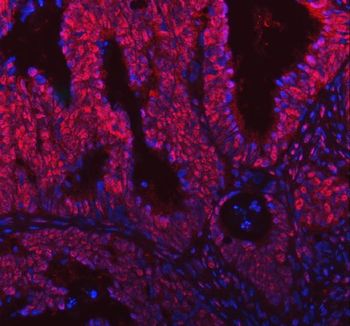 SNRNP200 Antibody
