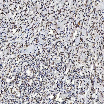 SNRNP200 Antibody