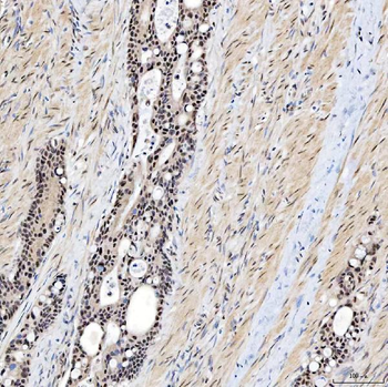 SNRNP200 Antibody