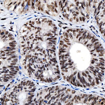 SNRNP200 Antibody