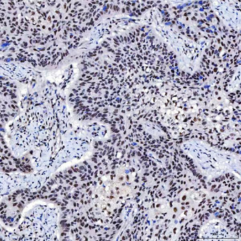 SNRNP200 Antibody